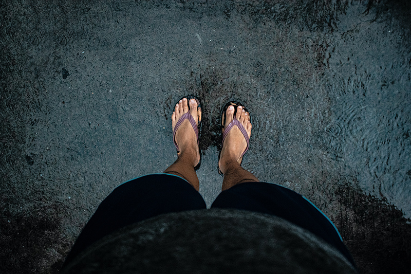 Is Wearing Flip-Flops a Bad Idea?