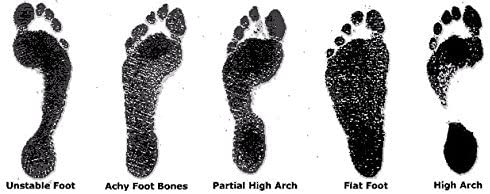 Types of arches image